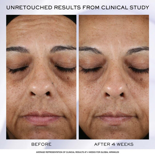 V2HCB855FB7BE53080A1EFD98754AAE6275R7815408P2